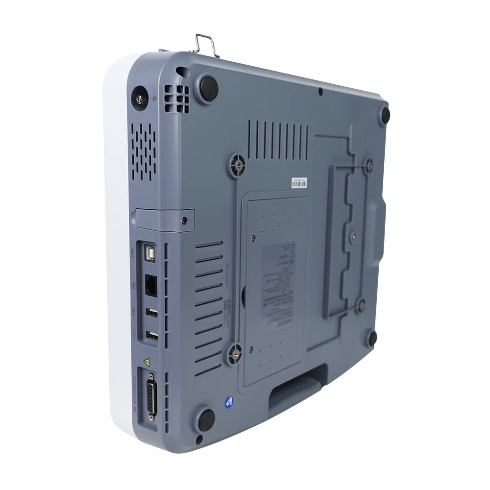 Фото Портативный 12-канальный электрокардиограф CONTEC ECG1212G (3, 6, 12 отведений) для измерения ЭКГ и частоты сердечных сокращений №2