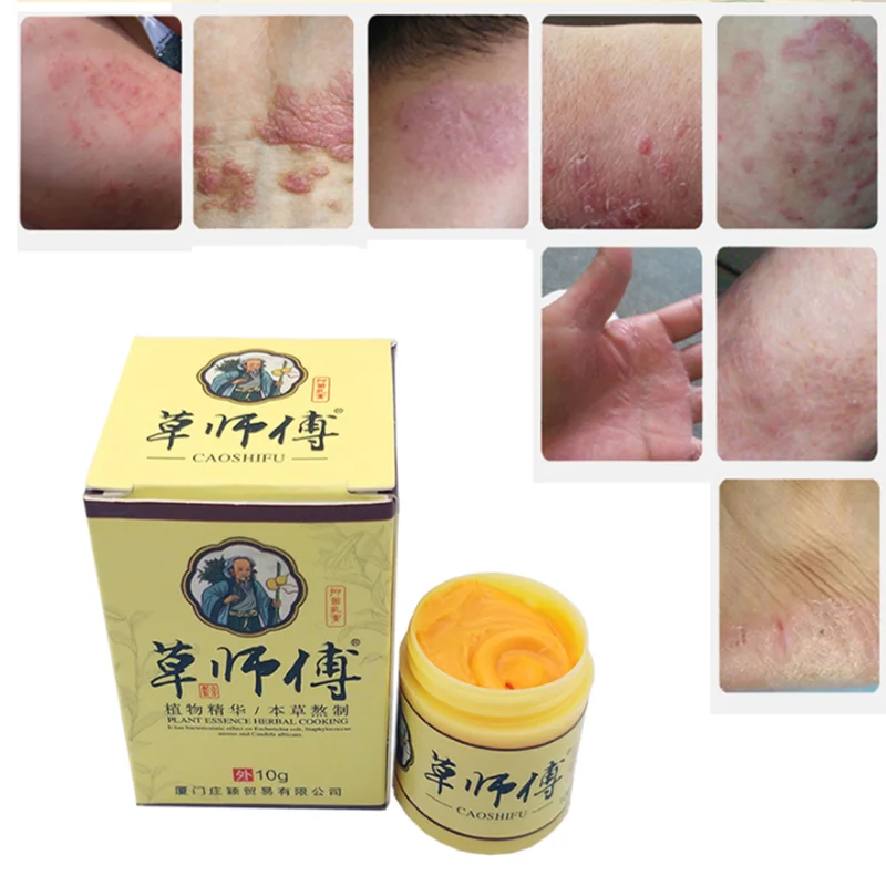 

10Pcs Chinese Herbal Medicine Psoriasis Eczma Cream For All Kinds Of Skin Problems Patch Body Massage Ointment herbal Medicine