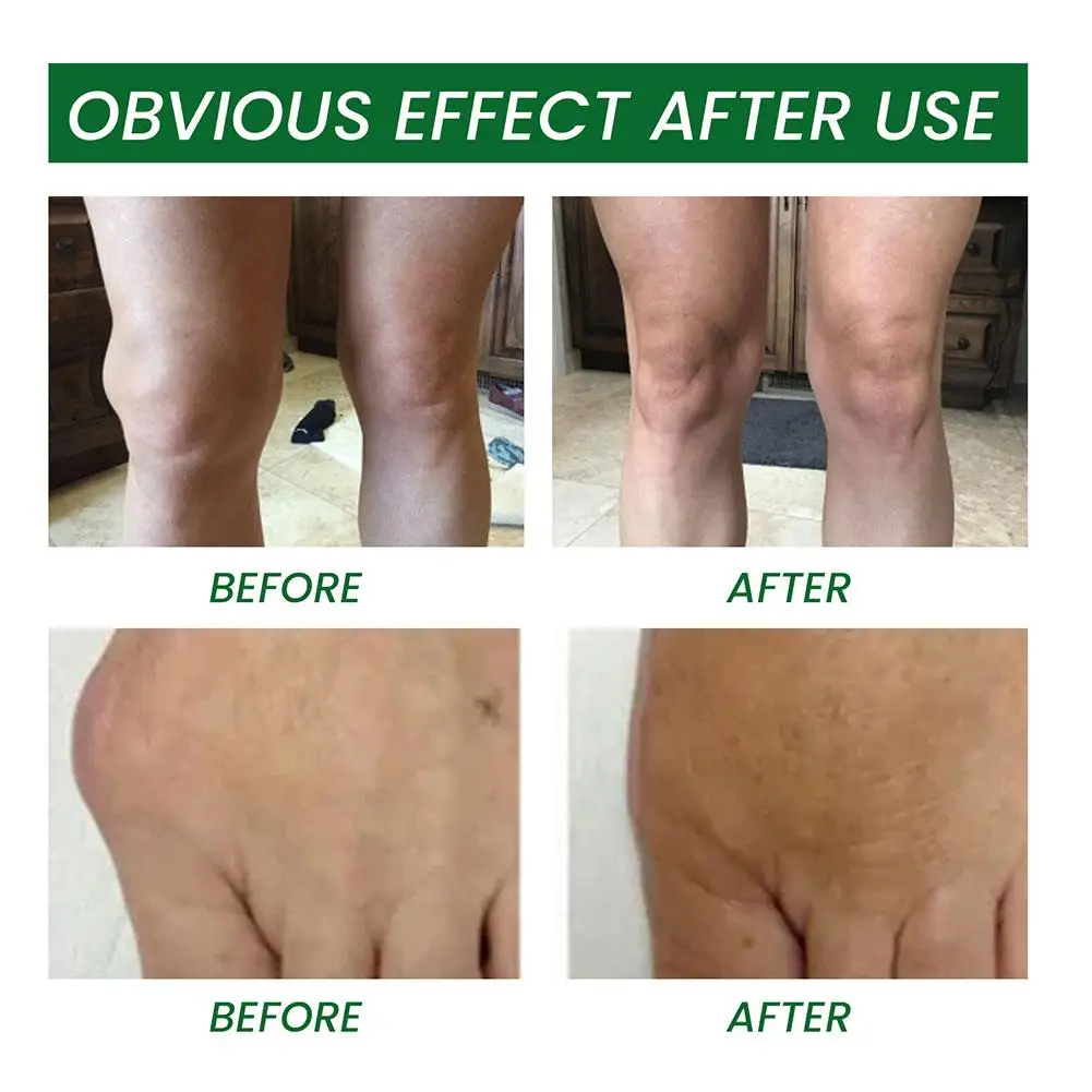 Рисунок 4 - Профессиональная суставная и костная терапия