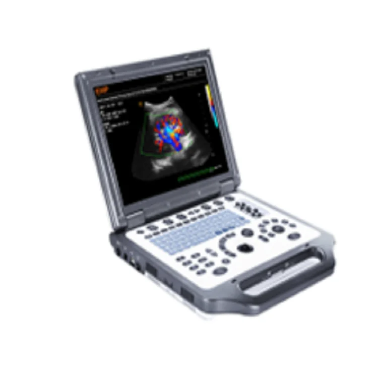Рисунок 4 - Карманный Ультразвуковой портативный
