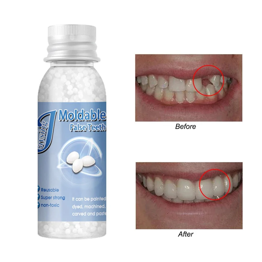 Полимерные накладные зубы твердый клей набор для временного ремонта зубов