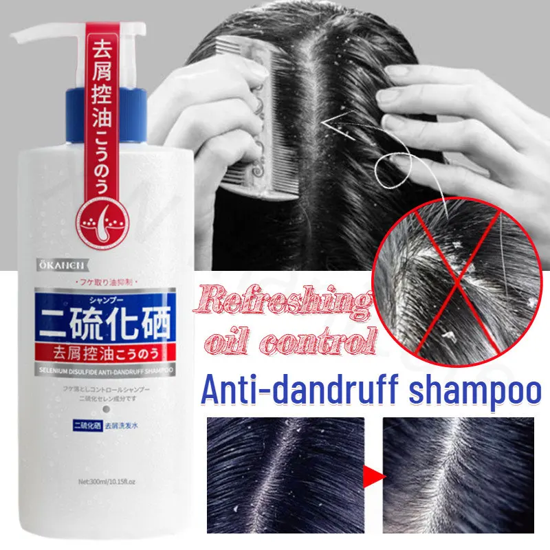 

Refreshing Oil Control, Improve Dry Hair, Refreshing Oil Control, Anti-dandruff Anti-itch Shampoo Relieve Seborrheic Scalp