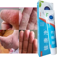 anti fungal infections antibacterial cream psoriasis herbal treatment eczema anti itch relief rash urticaria desquamation