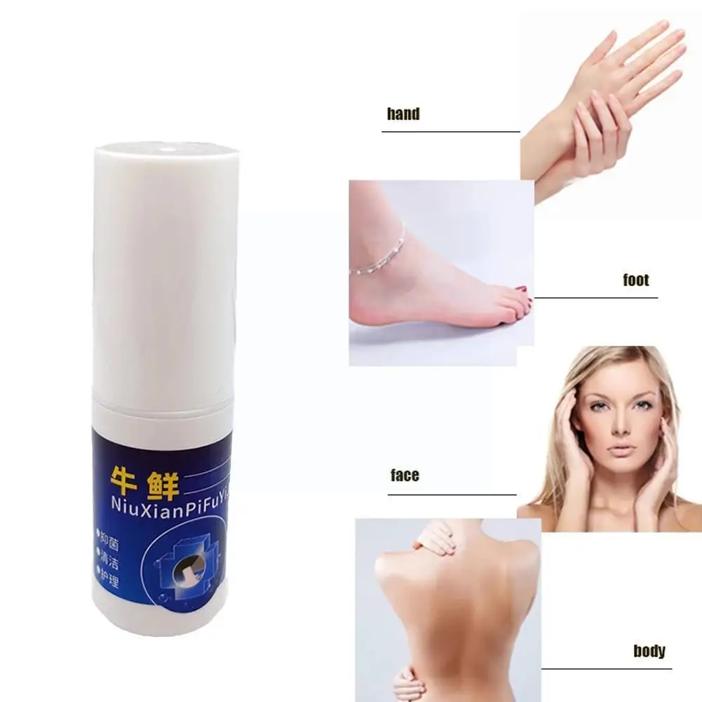 

New Relief Skin Probelm Ointment Spray Psoriasi Eczma Health Cream Uncomfortable Chinese Product Medical Skin Spray Herpes V3R4