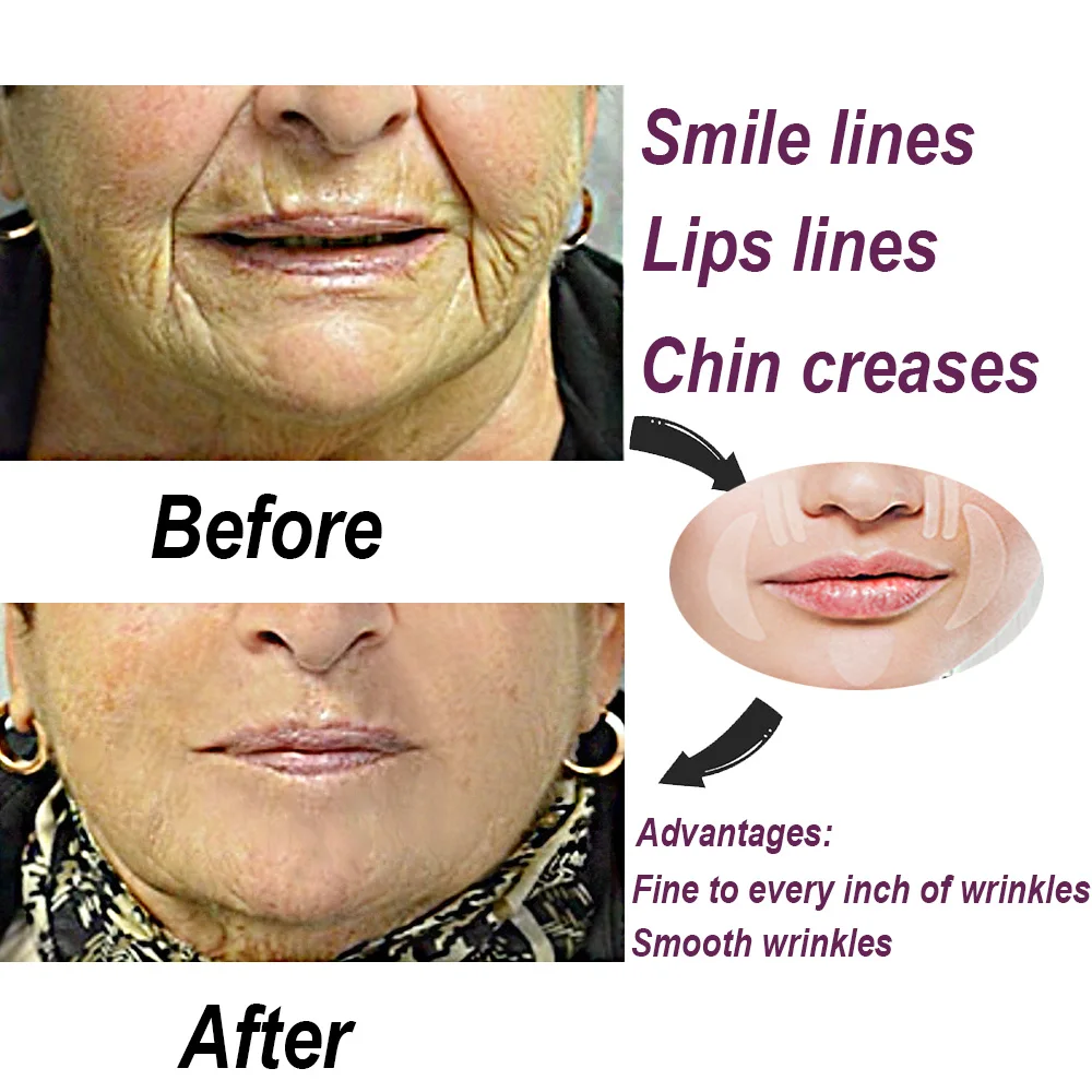 Рисунок 5 - Многоразовые патчи для морщин