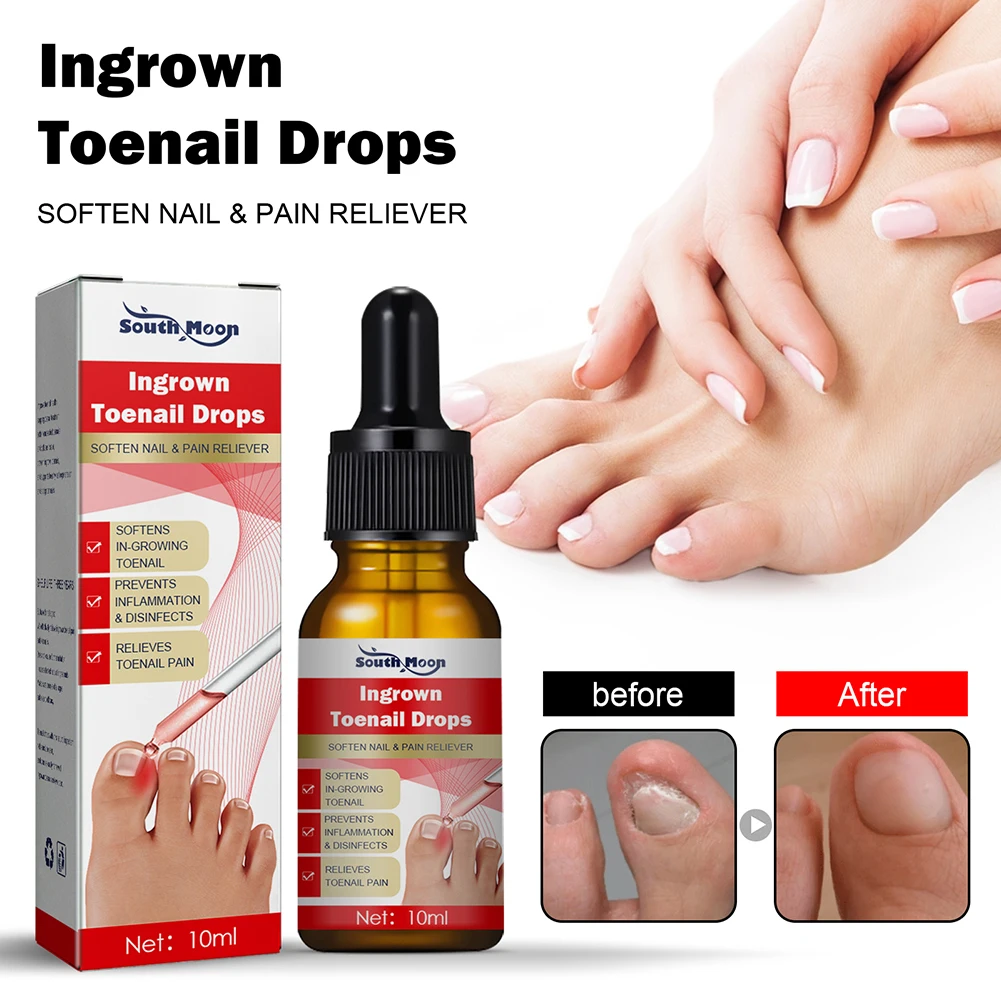 

Ingrown Toenail Treatment Serum Nail Correction Recover Oil Pain Reliever Nail Softener Trim with Ease Oil Feet Health Care