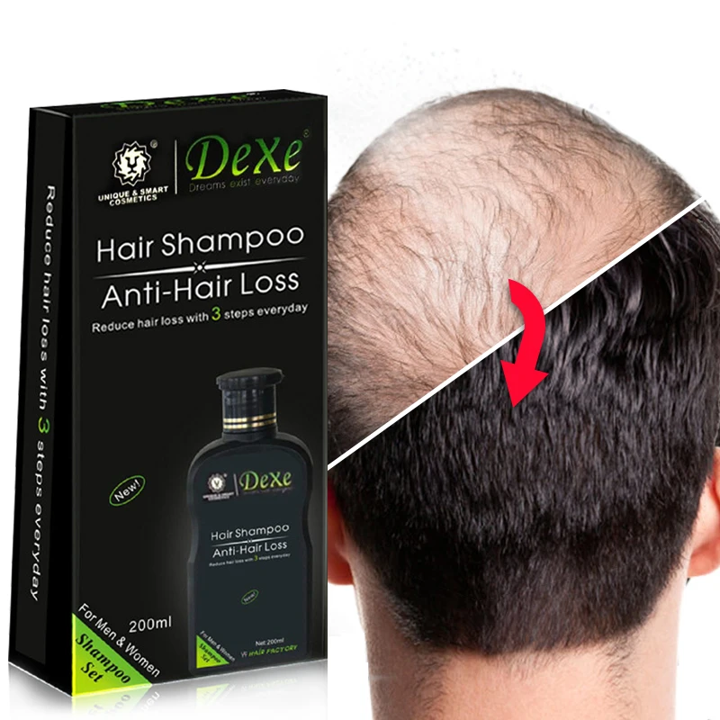 200ml Dexe Hair Anti hair loss Shampoo Chinese Herbal Hair Growth Product Prevent Hair Treatment For Men & Women free shipping