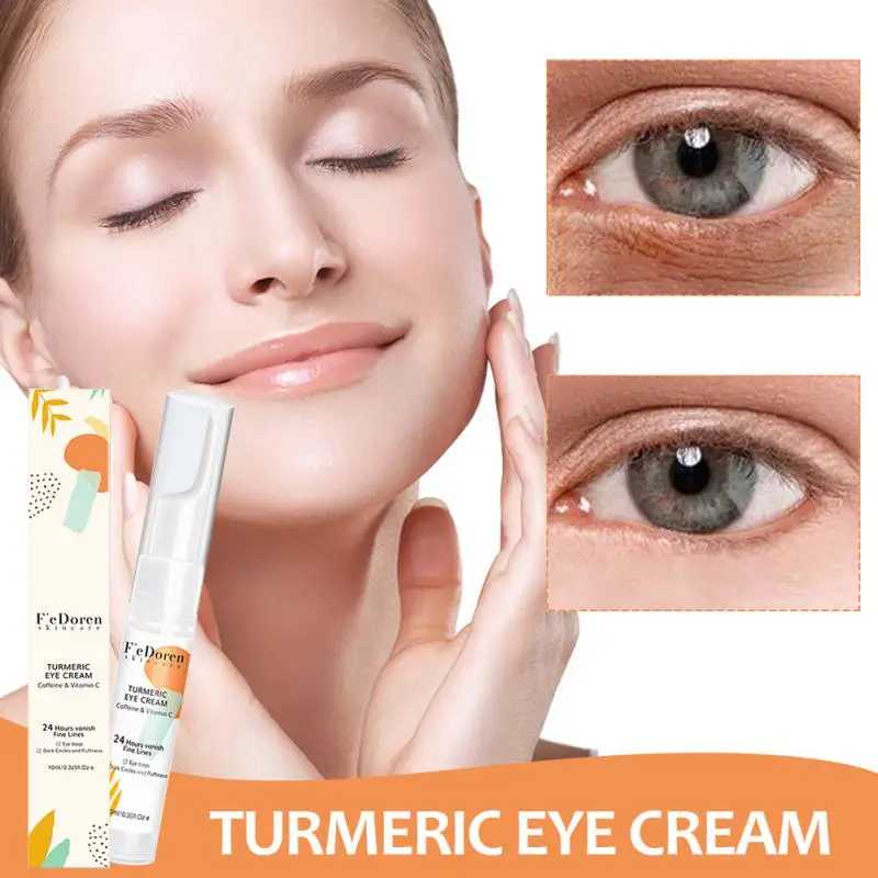 

Turmeric Eye Cream For All Skin Effectively Dilute Dark Circles Improve Eye Socket Complexion + Firm Skin Eye Care Beauty Health