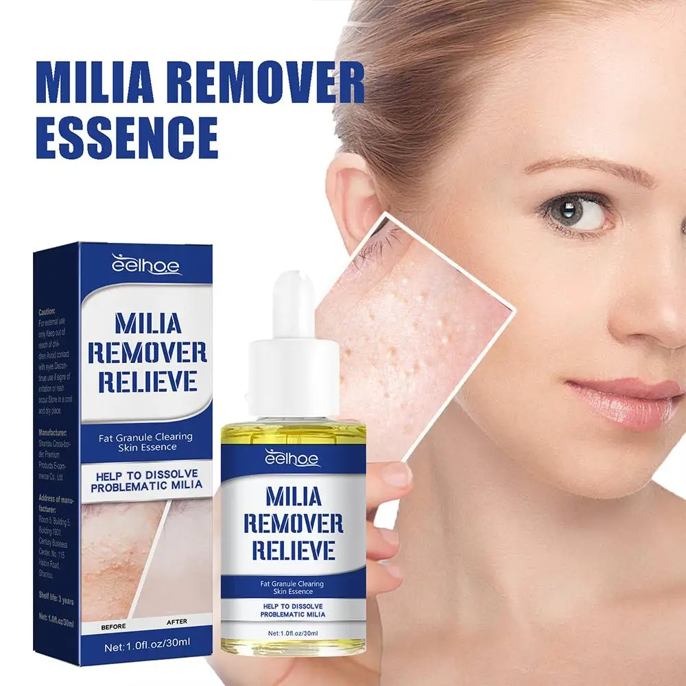 

30ml Milia Remover Relieve Serum Dark Spot Remover Dark Moisturizer Circle Reduce Beauty Helps Care Essences Brighten N4F4