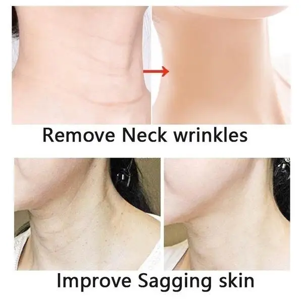 Neck Firming Cream, Anti Aging Moisturizer for Neck , Double Chin Reducer, Skin Tightening Cream - See Results In 3 Days 4