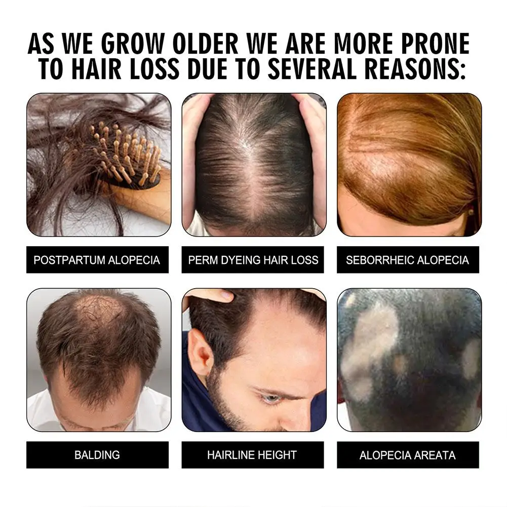 Рисунок 5 - имбирное мыло для стимулирования