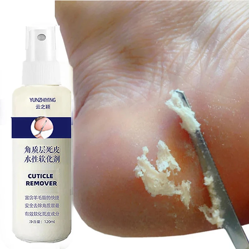 Спрей отшелушивающий для удаления омертвевшей кожи и мозолей