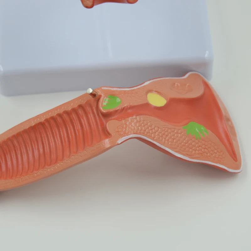 Патологическая модель матки Женская репродуктивная система обучающий