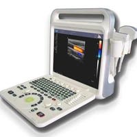 e60 3d4d optional portable color doppler diagnostic medical ultrasound instruments