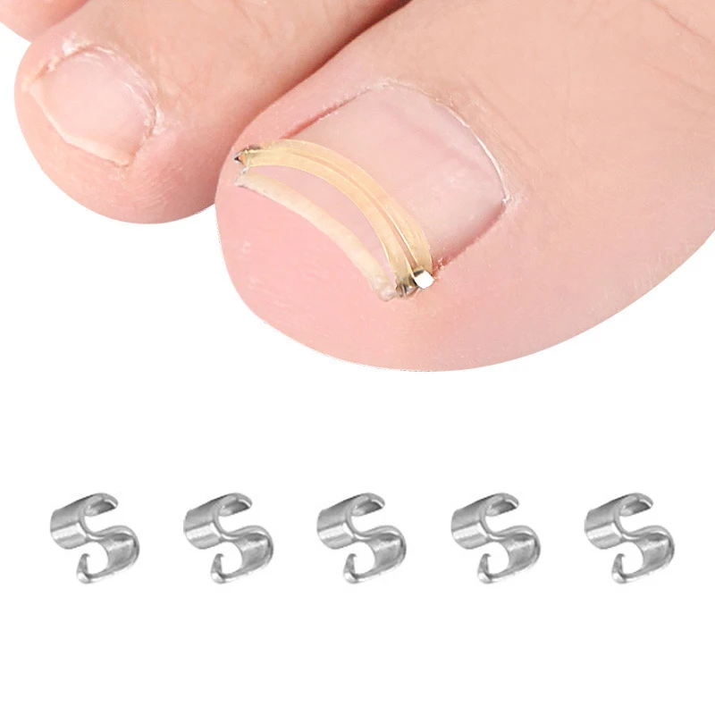 Корректор для вросших ногтей профессиональный инструмент коррекции педикюра