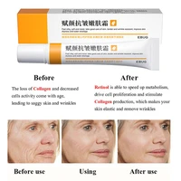 retinol face cream firming lifting anti aging remove wrinkles fine lines whitening brightening moisturizing facial skin care 20g