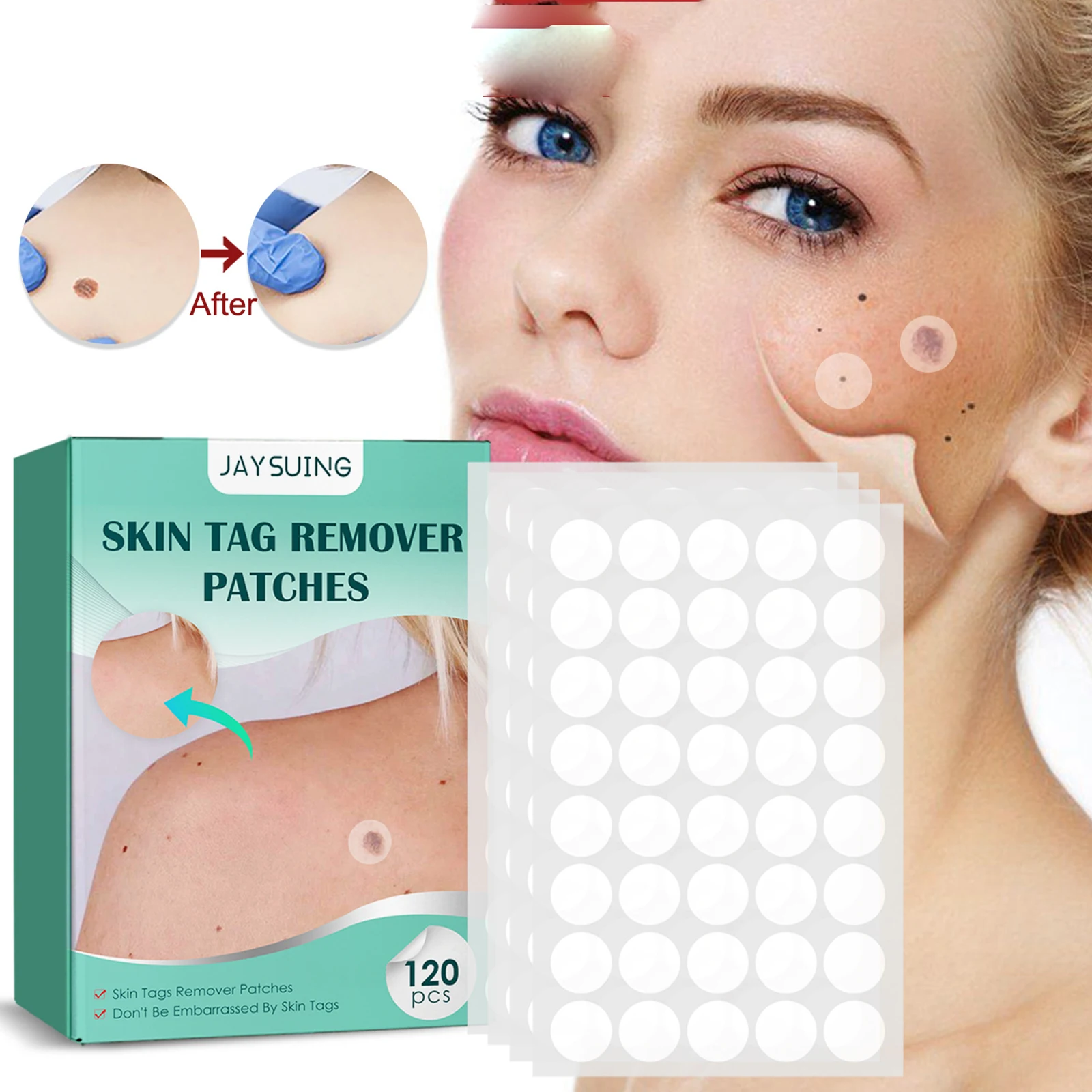 

Wart Removal Patch Skin Mole Cleanse Care Get rid of corns flesh prick warts flesh grain acanthosis filiform