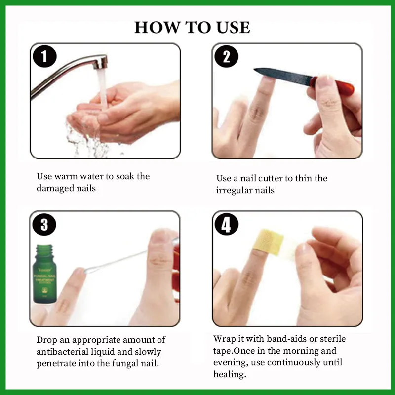 Сыворотка для лечения грибка ногтей антиинфекционное удаление онихомикоза