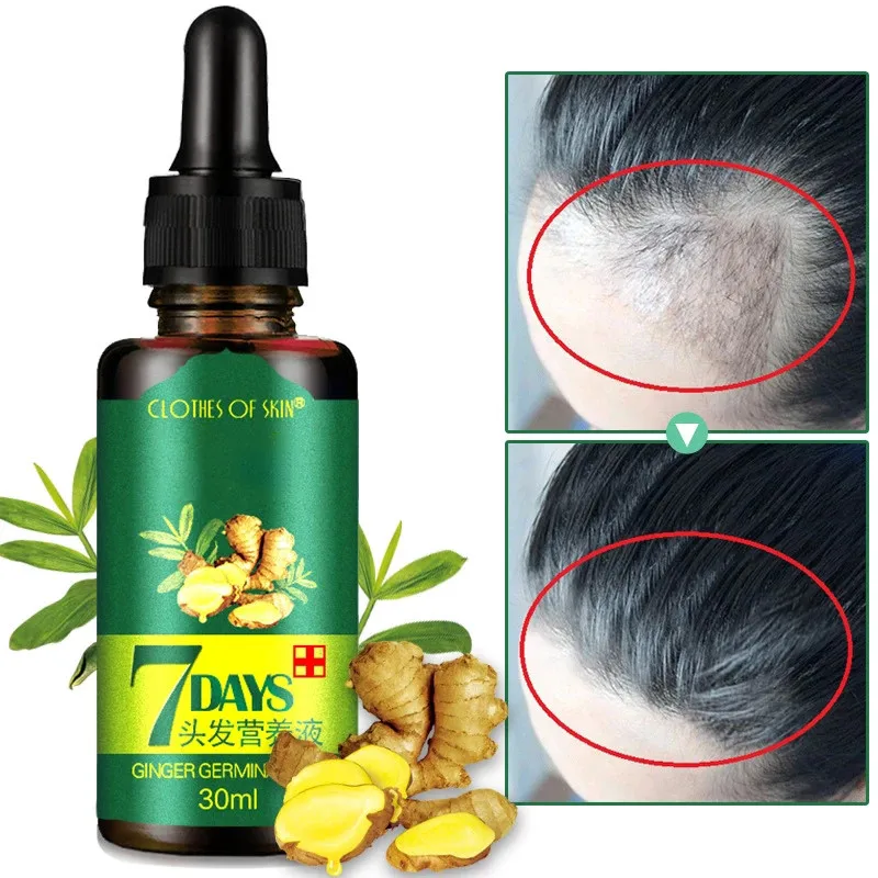 Chinese Ginger Hair Growth Serum 7 Days Germinal Hair Growth Spray Anti-Hair Loss Oil Treatment Fast Growing New Hair Man Woman