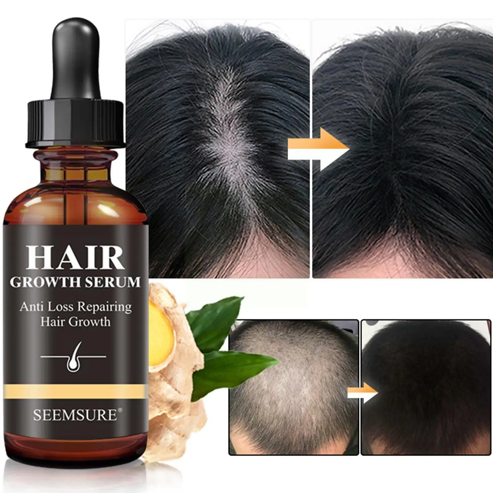 

Ginger Hair Growth Products Fast Growing Hair Essential 30ml Hair Dry Thinning Prevent Oils Care Damaged Frizzy Repair A6X1
