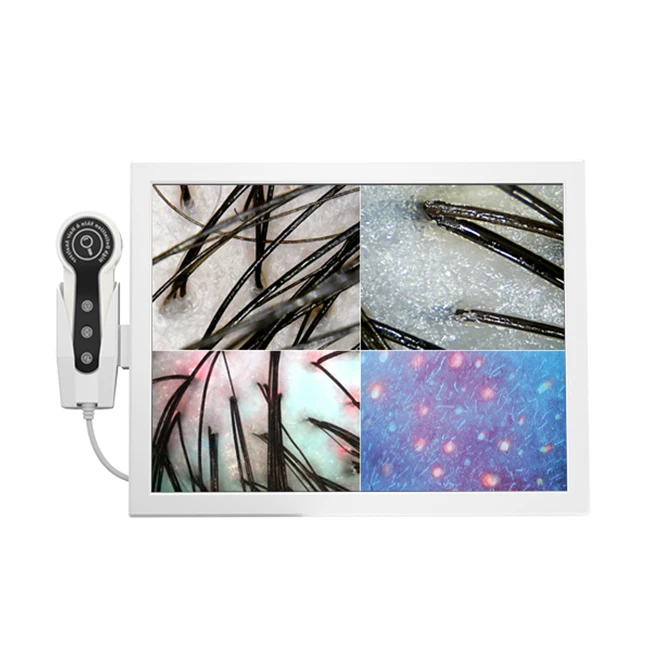 Портативный анализатор кожи анализа пор детектор волосяных фолликулов SA-S04A