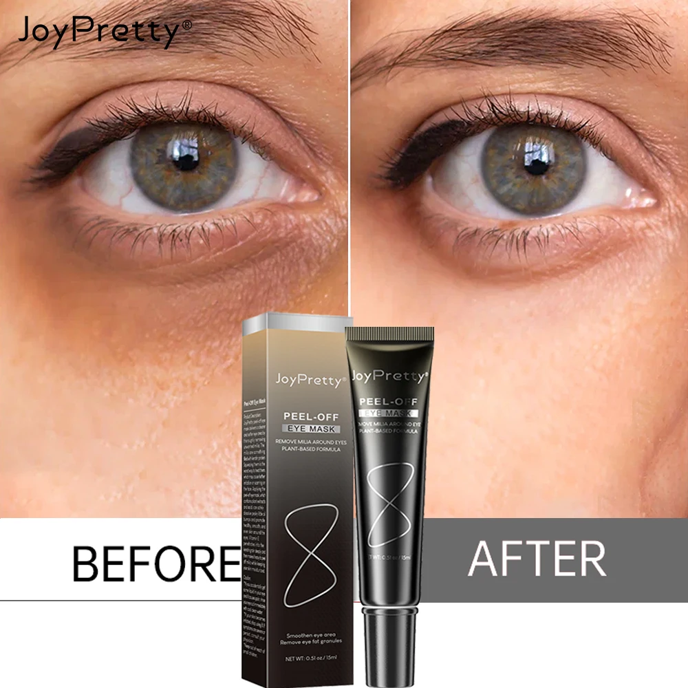 

Eye Bags Remover Eye Cream Whitening Anti Dark Circle Anti-Puffiness Products Vitamin E Eyes Wrinkle Removal Lift Firm Skin Care