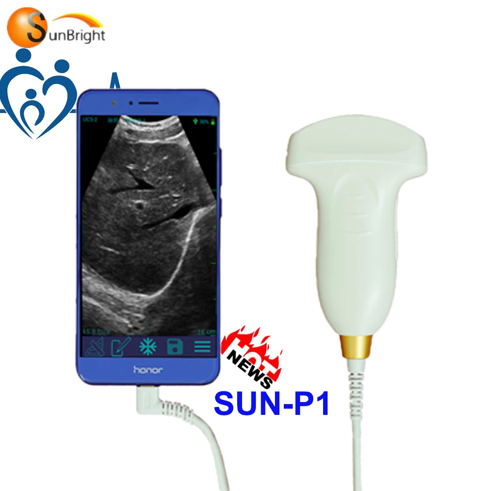 

Sunbright 2D USB Wireless usb ultrasound probe SUN-P1 for Bladder