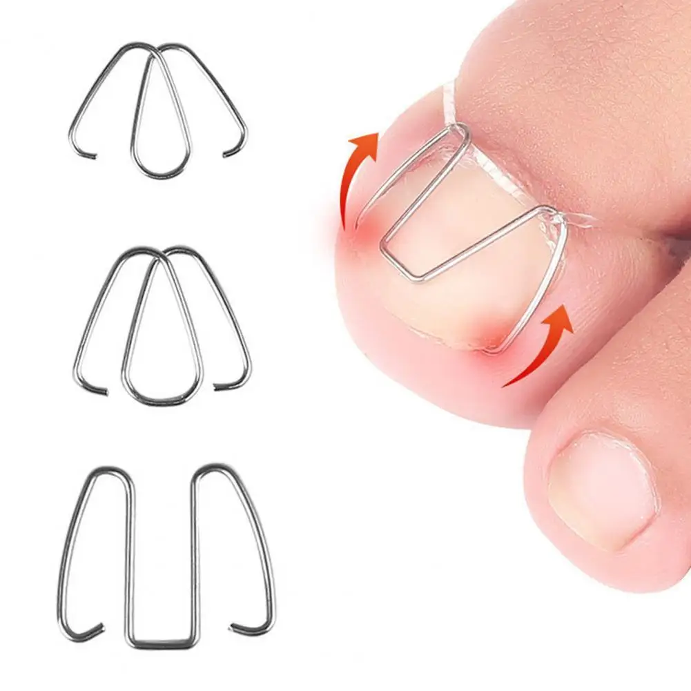 

1 Set Practical Toe Nail Correction Toenail Fixer Nail Treatment Anti-pain