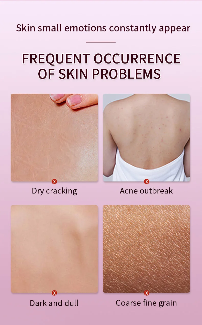 Отбеливающий крем Niacinamide для кожи удаления пигментации лосьон ухода за телом