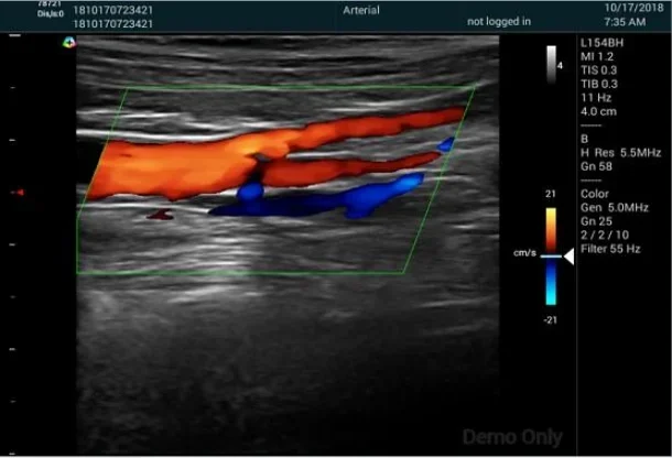 Рисунок 3 - Ветеринарное оборудование для ультразвукового