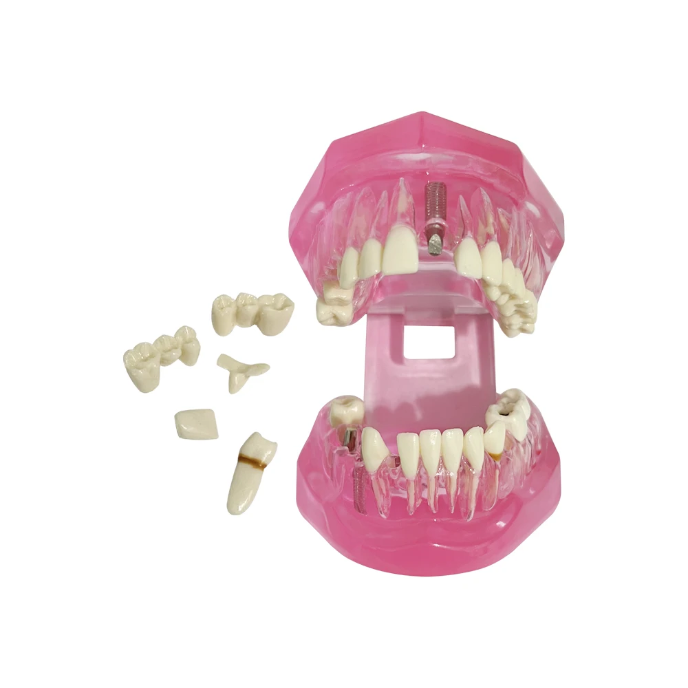 Модели зубов ремонтные модели из смолы для изучения и исследования медицины