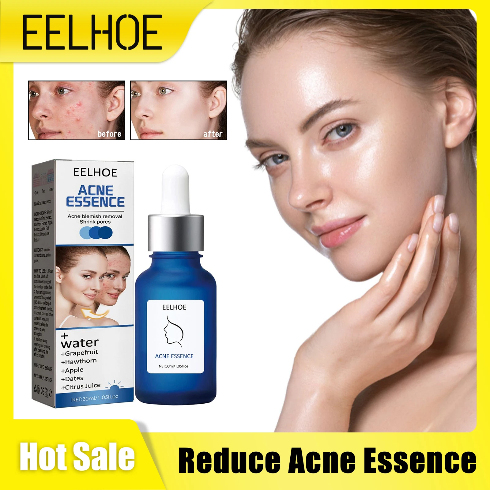 

Reduce Acne Essence Pimple Scar Removal Fade Marks Oil Control Moisturizing Repairing Whitening Pore Shrink Acne Treatment Serum