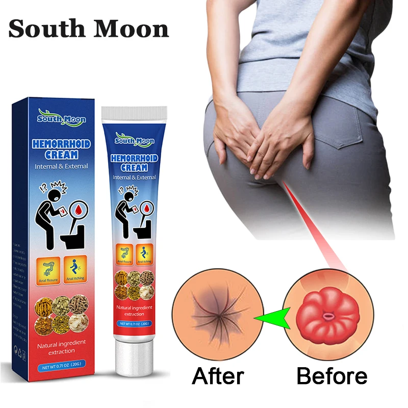 

Chinese Herbal Hemorrhoids Ointment Relieve Anal Pain Swell Bleed Internal Piles External Anal Fissure Therapy Medical Plaster