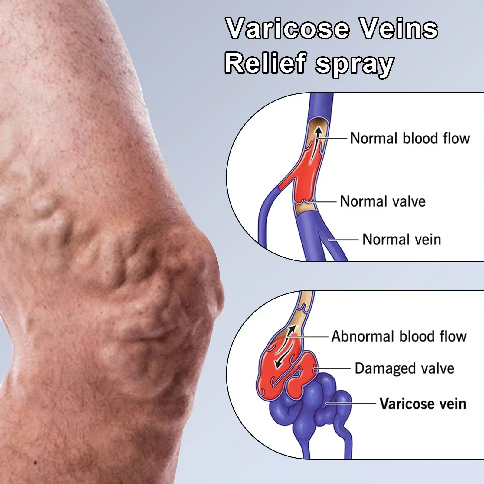 Крем от варикозного расширения вен Earthworm-Успокаивающий массажный бальзам для