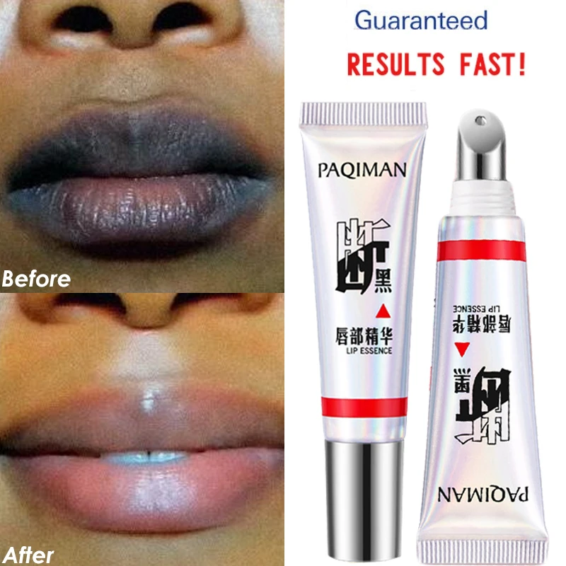 

Lips Pink Fresh Lightening Bleaching Cream Treatment Remove Dark Smoke Lips Lips Bleaching whitening Essence Lip Balm