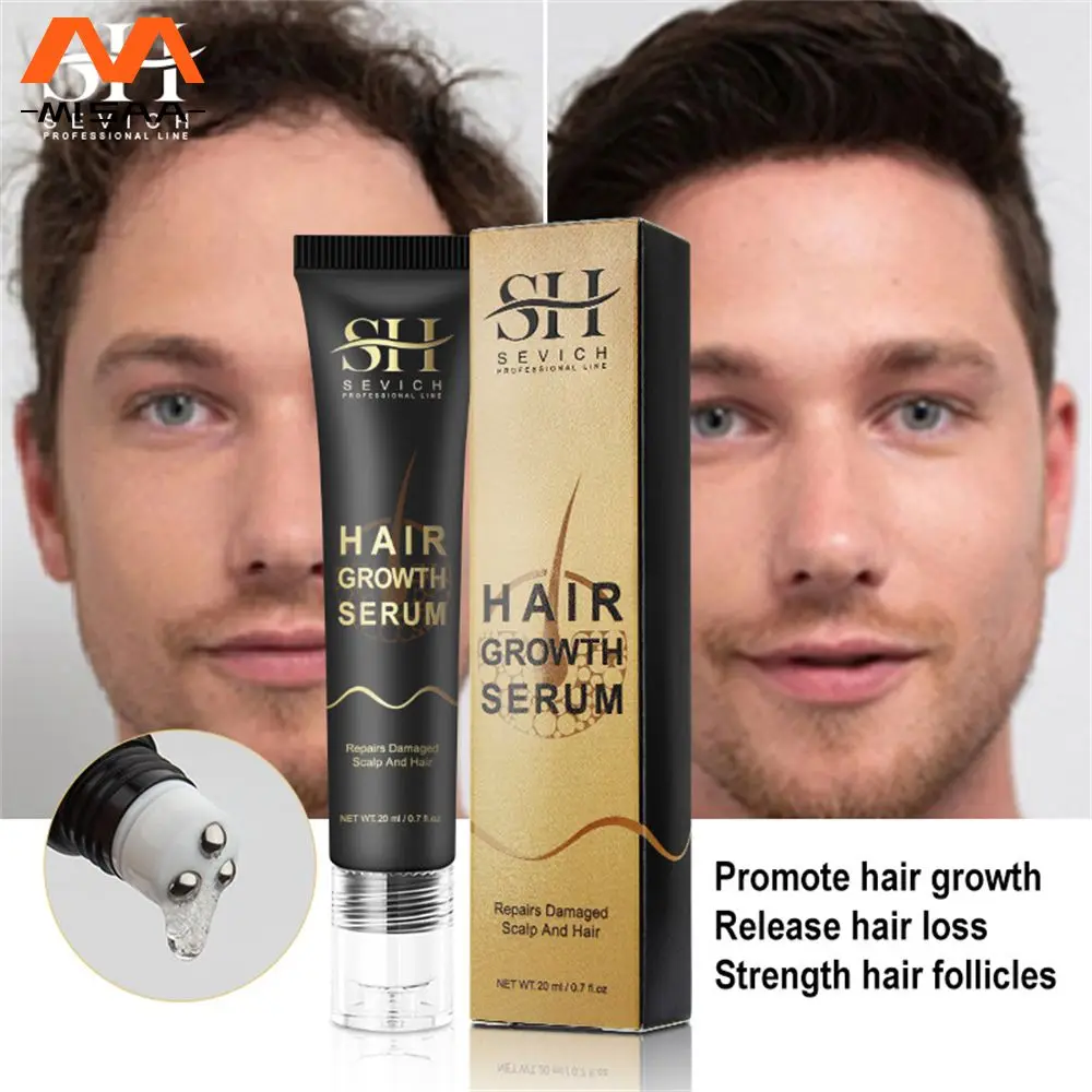 

20ml Dense Hair Remove Grease Hair Products Massage The Scalp Reduce Dandruff Scalp Care Mild Moisturizing