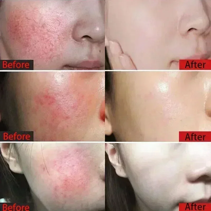 Лидер продаж 7-дневный восстанавливающий крем от покраснений лица успокаивающий