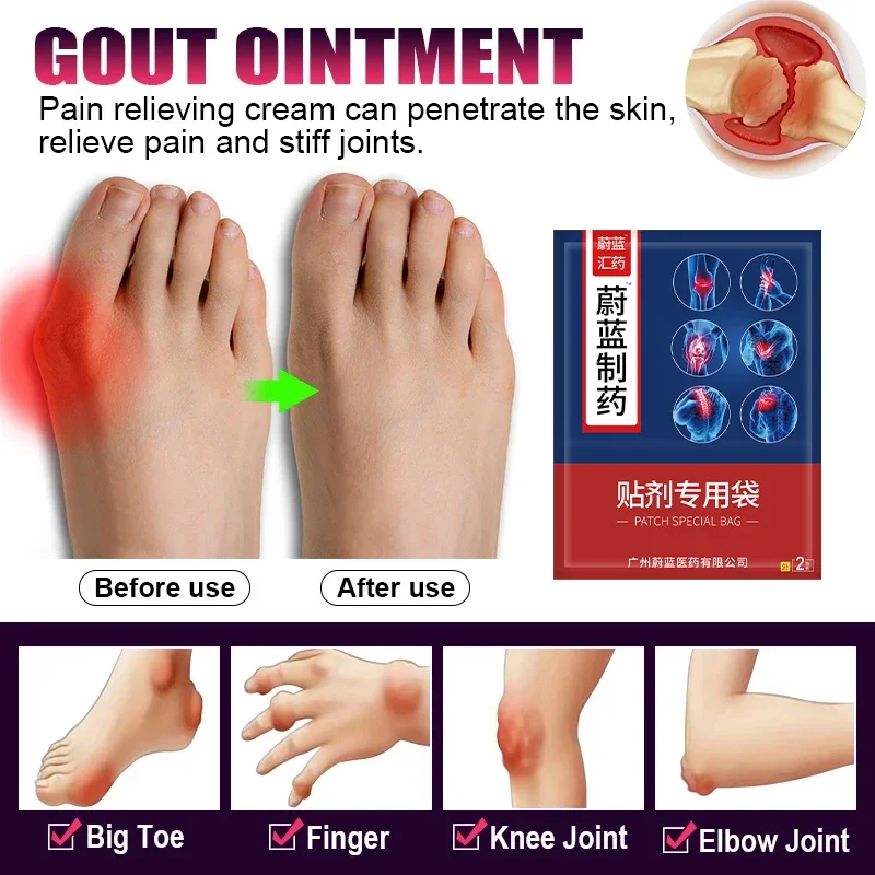Пластырь для лечения подагры корректор большого пальца суставов артрита боли в