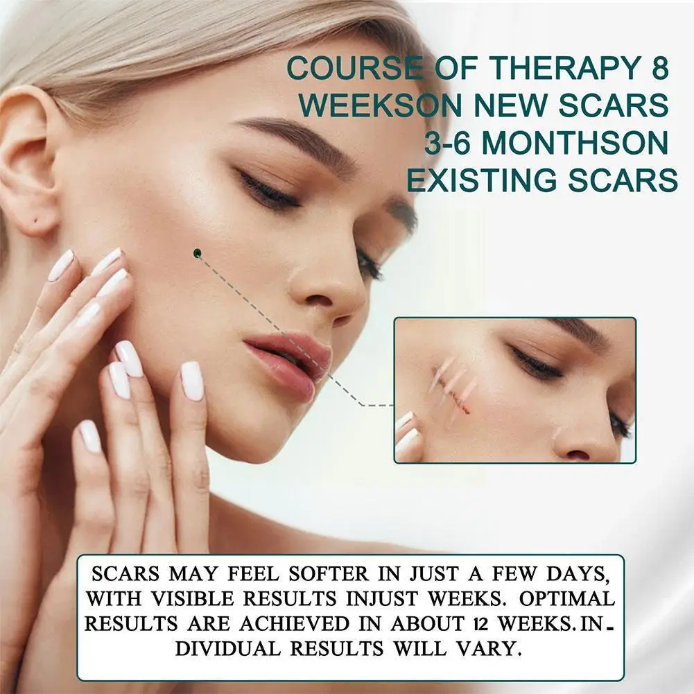 

4*150cm Surgery Scar Removal Silicone Gel Patch Treatment Skin Acne Sheet Burn Trauma Tools Efficient Scar Tape Therapy Rep Q3a0