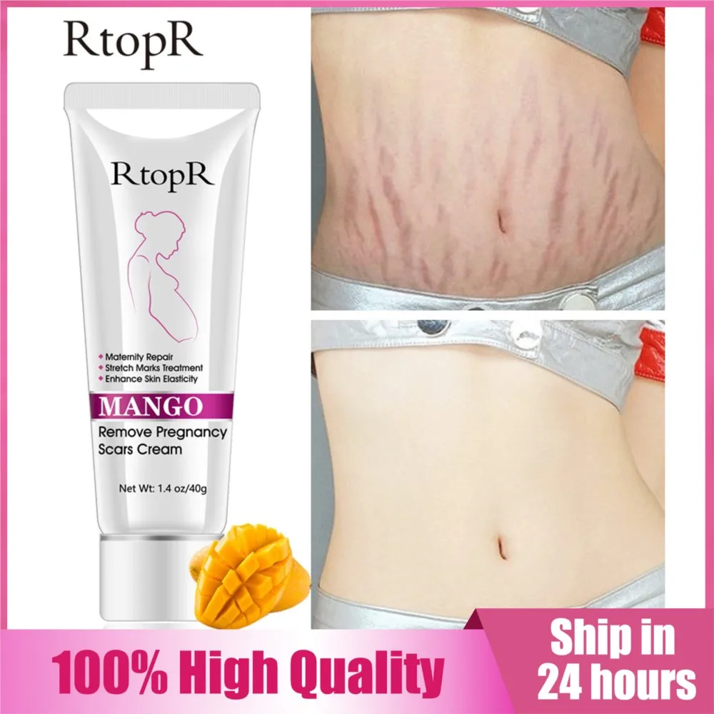 

RtopR Mango Remove Pregnancy Scars Acne Cream Stretch Marks Maternity Repair Anti-Aging Anti-Winkles Firming Lifting Body Creams