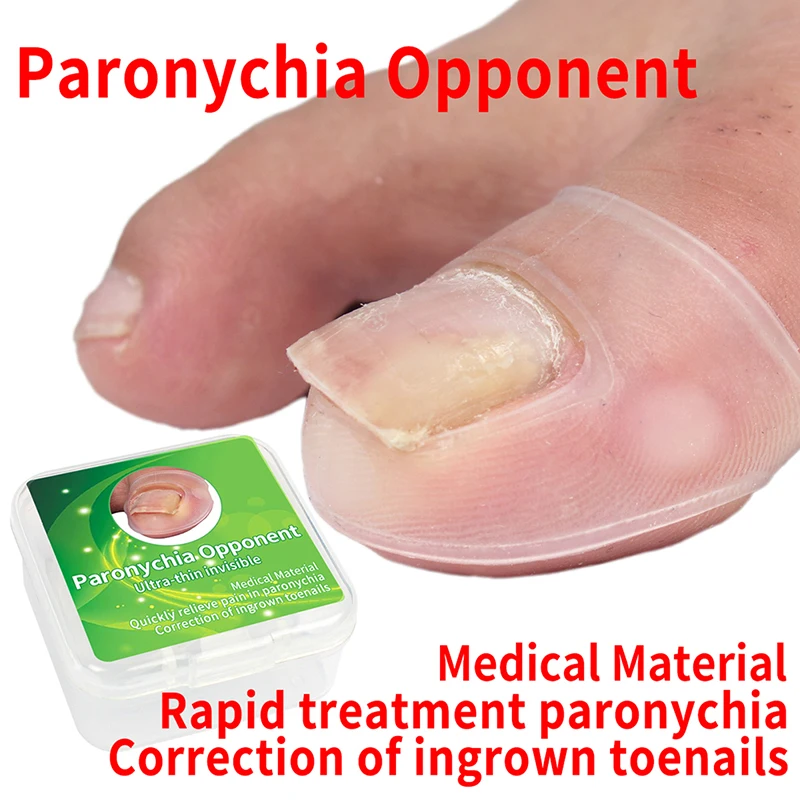 

2Pc Silicone Ingrown Toenail Correction Tool Invisible Ingrown Toe Nail Treatment Elastic Straightening Clip Brace Pedicure Tool