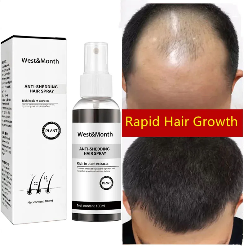 

Fast Hair Growth Spray Anti Hair Loss Products Scalp Repair Treatment Improve Dry Damaged Thinning Frizzy Nourishing Health Care