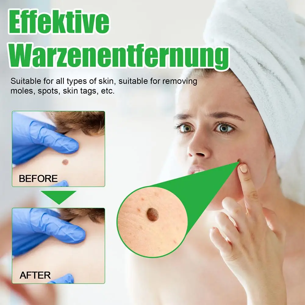 Рисунок 6 - Средство для устранения веснушек и бородавок