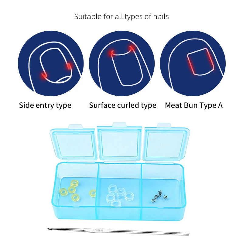 1 комплект корректор для вросших ногтей педикюр восстановление лечение на ногах