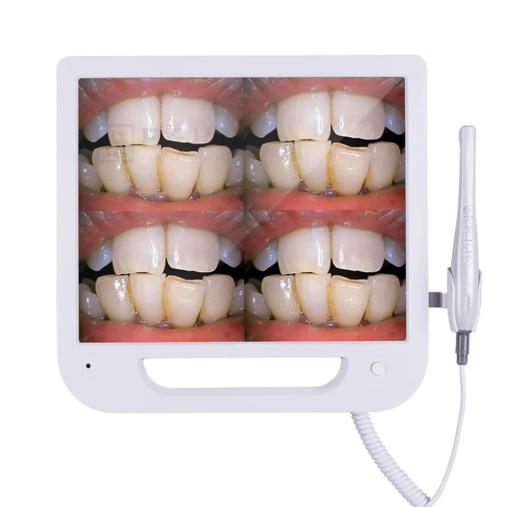 

Dental Camera Wifi HD 8 Million Pixels High-definition Endoscope Tools 17 Inches Digital LCD Monitor Dental Intraoral Instrument