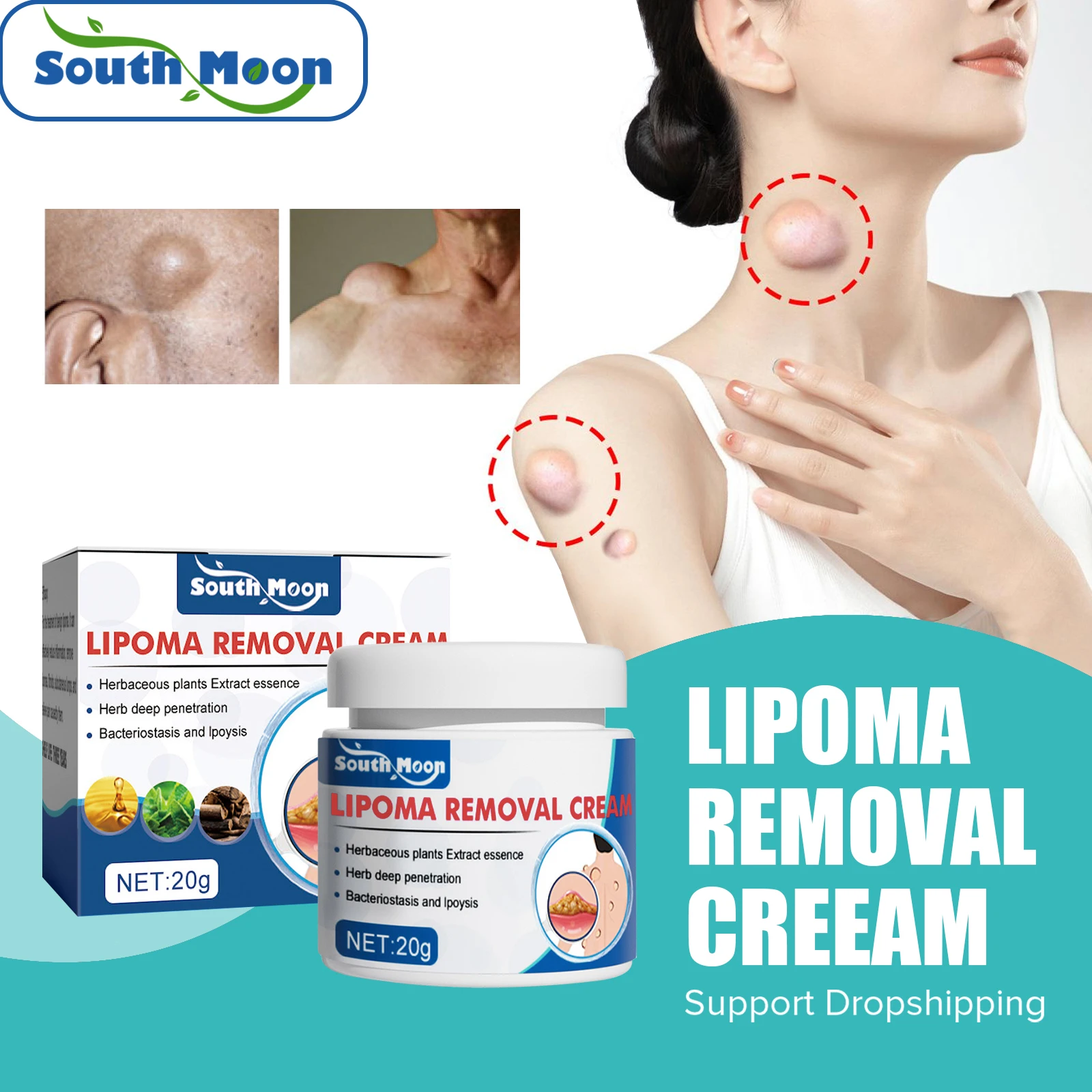 

South Moon Lipoma Cream Original Delipidation Treatment Pain Relief Lipolysis Cellulite Fat Lump Nodule Tumor Removal Ointments