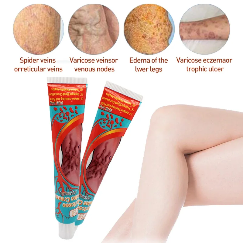 

20g 10pcs Natural Varicose Veins Ointment Plaster Beauty Body Repair Care Dressing Vasculitis Phlebitis Spider Analgesics Cream