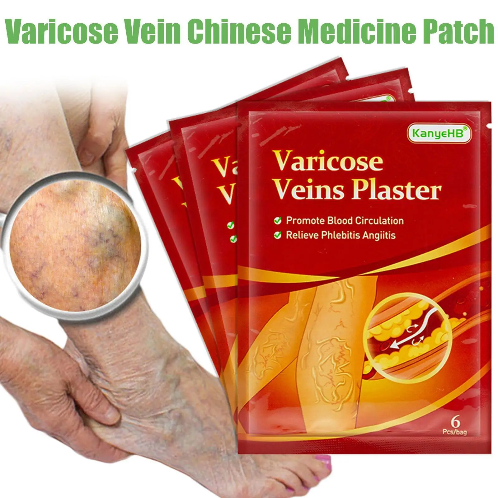 

6Pcs=1Bag Varicose Veins Plaster Chinese Herbal Medical Patch Treat Vasculitis Phlebitis Spider Leg Veins Pain Plaster