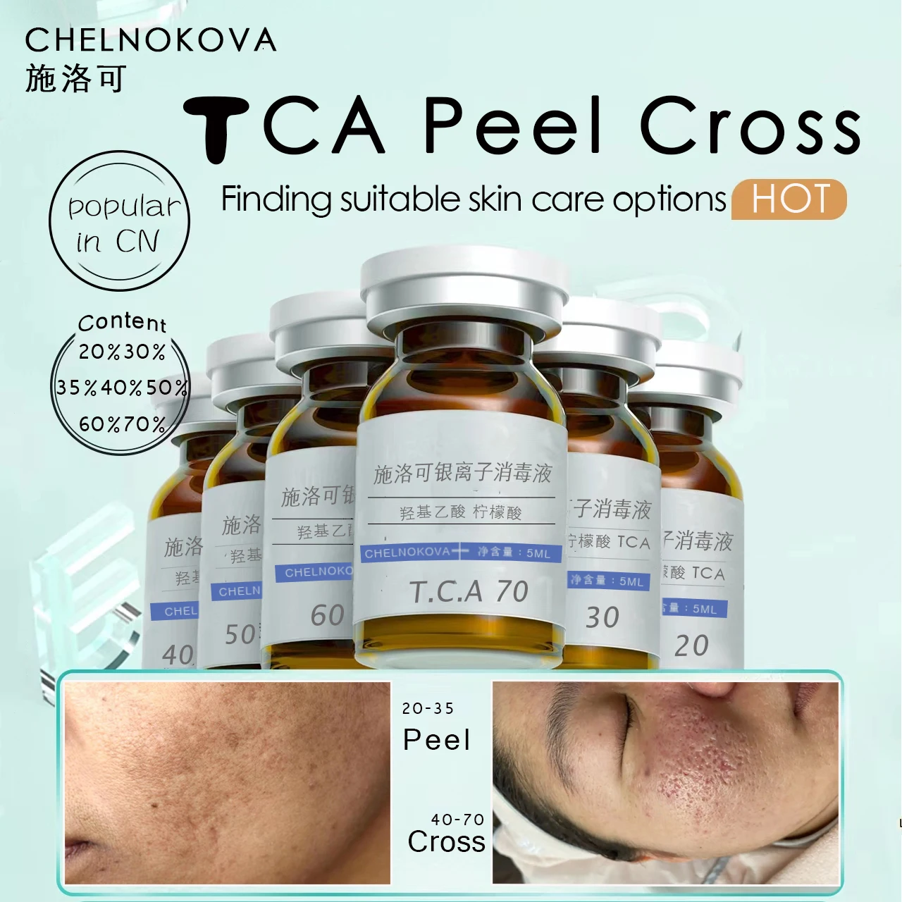 TCA 20% 30% 50% 70% tca Peel Acid Peeling Acid 7-15 Days Delivered Skin Superforce peeling Pigmentation Acne scar