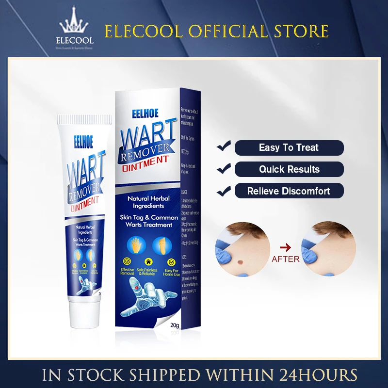 

Бородавка, искусственная бородавка, антибактериальная мазь для удаления кожи, экстракт, кукурузный пластырь для ног, мазь для бородавок